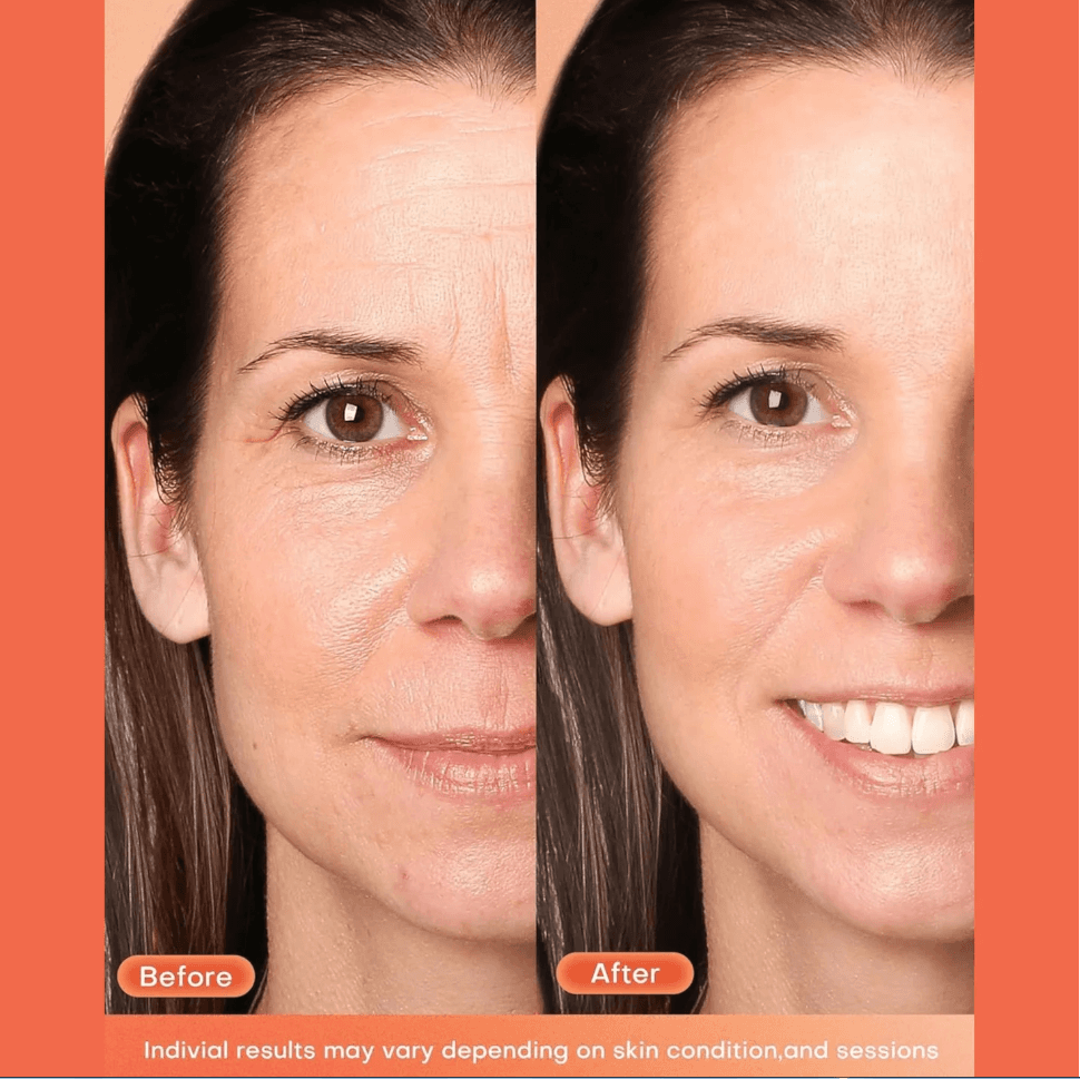 LED Maska za Pomlađivanje Lica 4